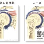 後ろに手が回らない【平塚市五十肩専門治療院】