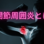 肩関節周囲炎のは何か？症状は？原因は？わかりやすく解説します！