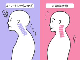 悪い姿勢の画像