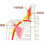 胸郭出口症候群の説明画像