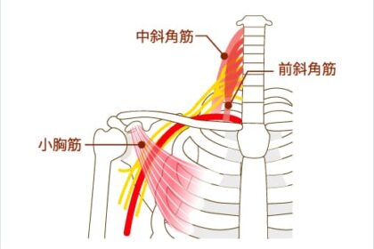 胸郭出口症候群の説明画像