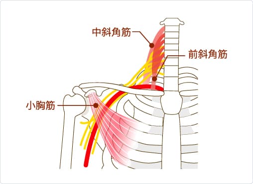 胸郭出口症候群の説明画像